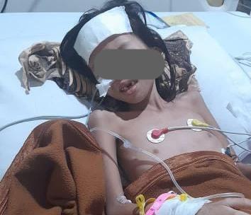 DA (7 tahun) saat mendapat perawatan di salah satu RS swasta di Palembang